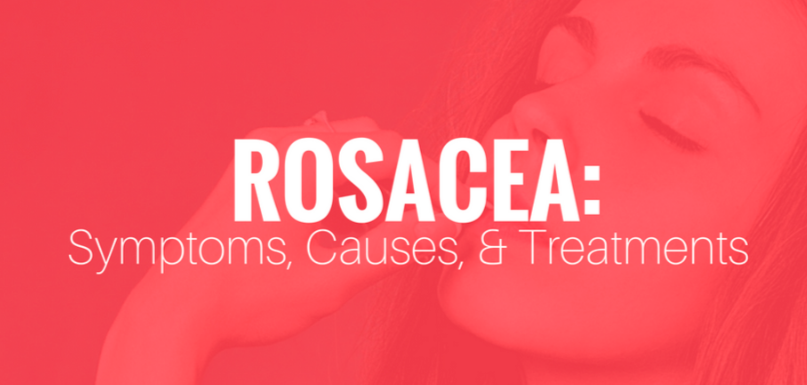 text against red background reading "Rosacea: Symptoms, Causes, & Treatments"