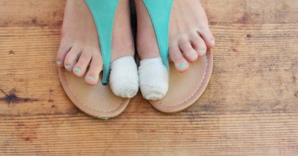 feet in sandals with bandage on big toes